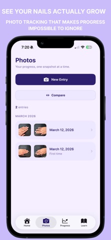 NoBite: Stop Nail Biting Screenshot 2 of 7