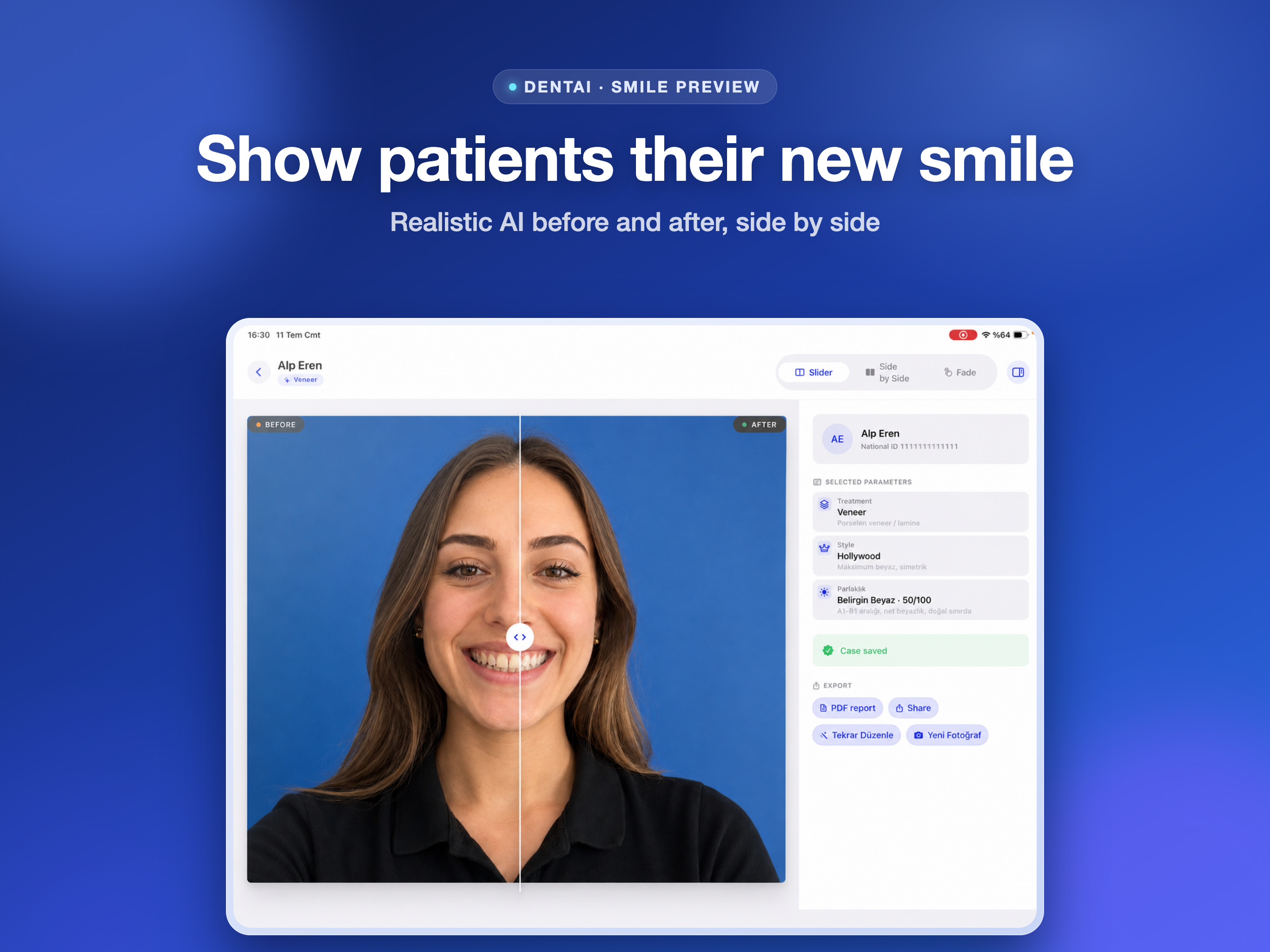 DentAI: Dental Preview AI screenshot 5