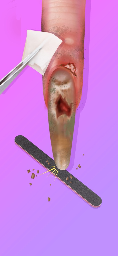 Nail Salon - Girl Art Game - Experience the satisfaction of therapeutic care with tools like precise tweezers and a shaping nail file to restore unhealthy nails.