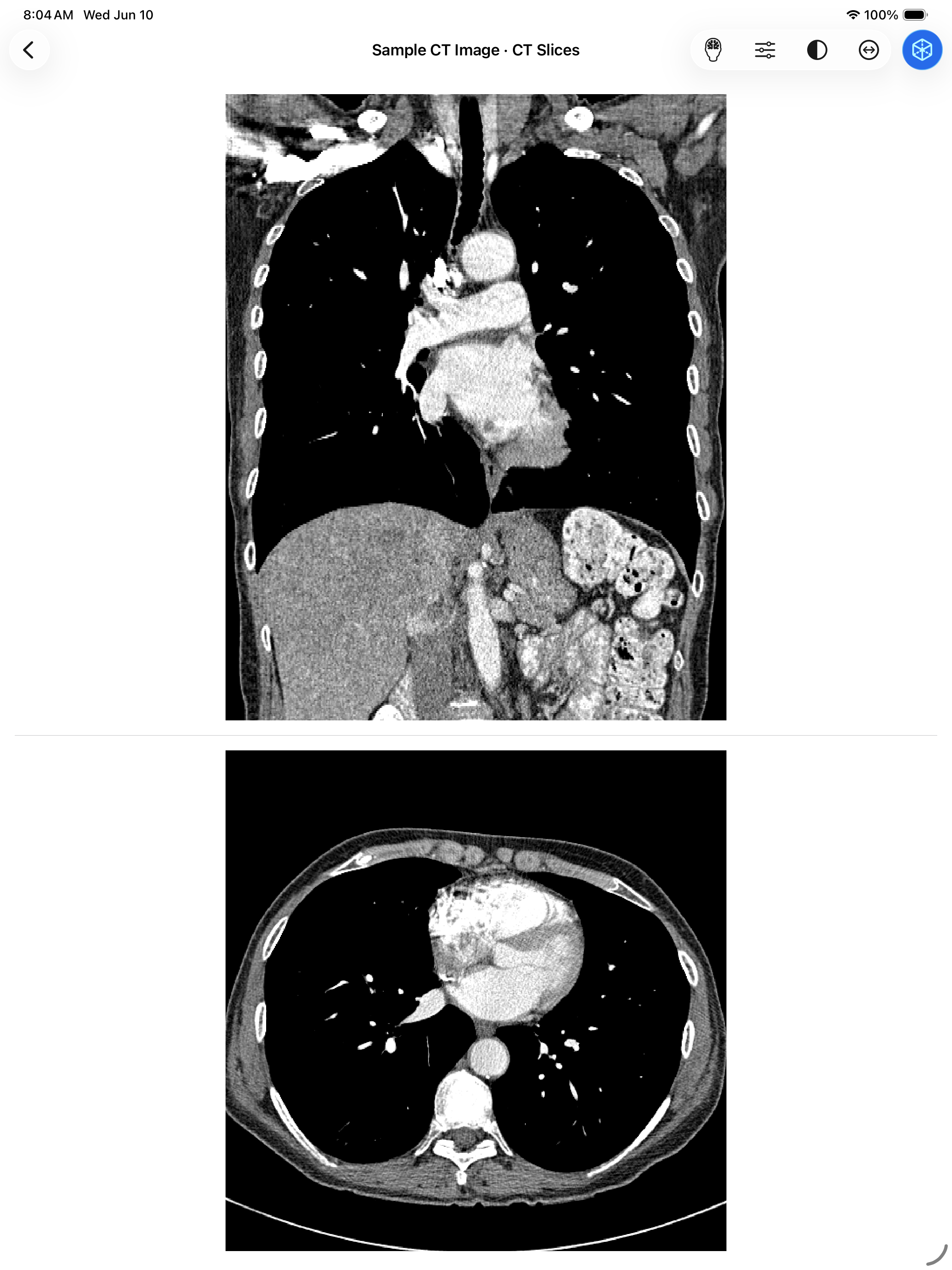 VoxelVision AR Medical Imaging