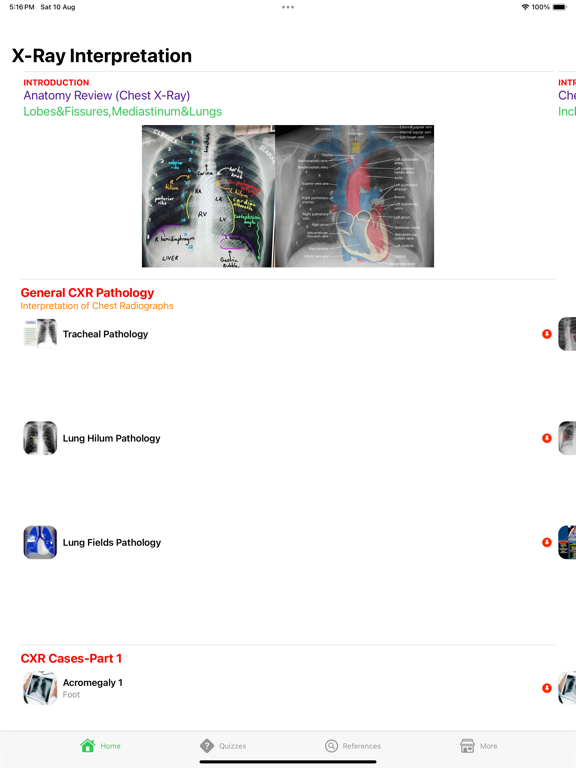 Screenshot #4 pour X-Ray Interpretation Guide