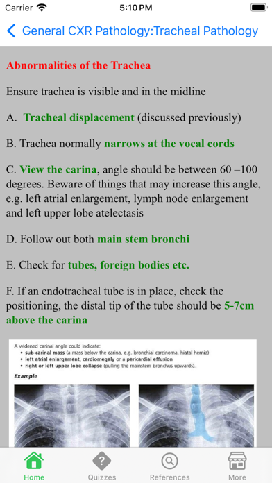 X-Ray Interpretation Guide Screenshot