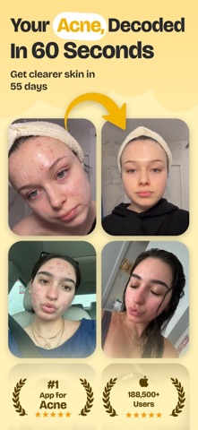 Puffin: Acne Tracker Screenshot 1 of 10