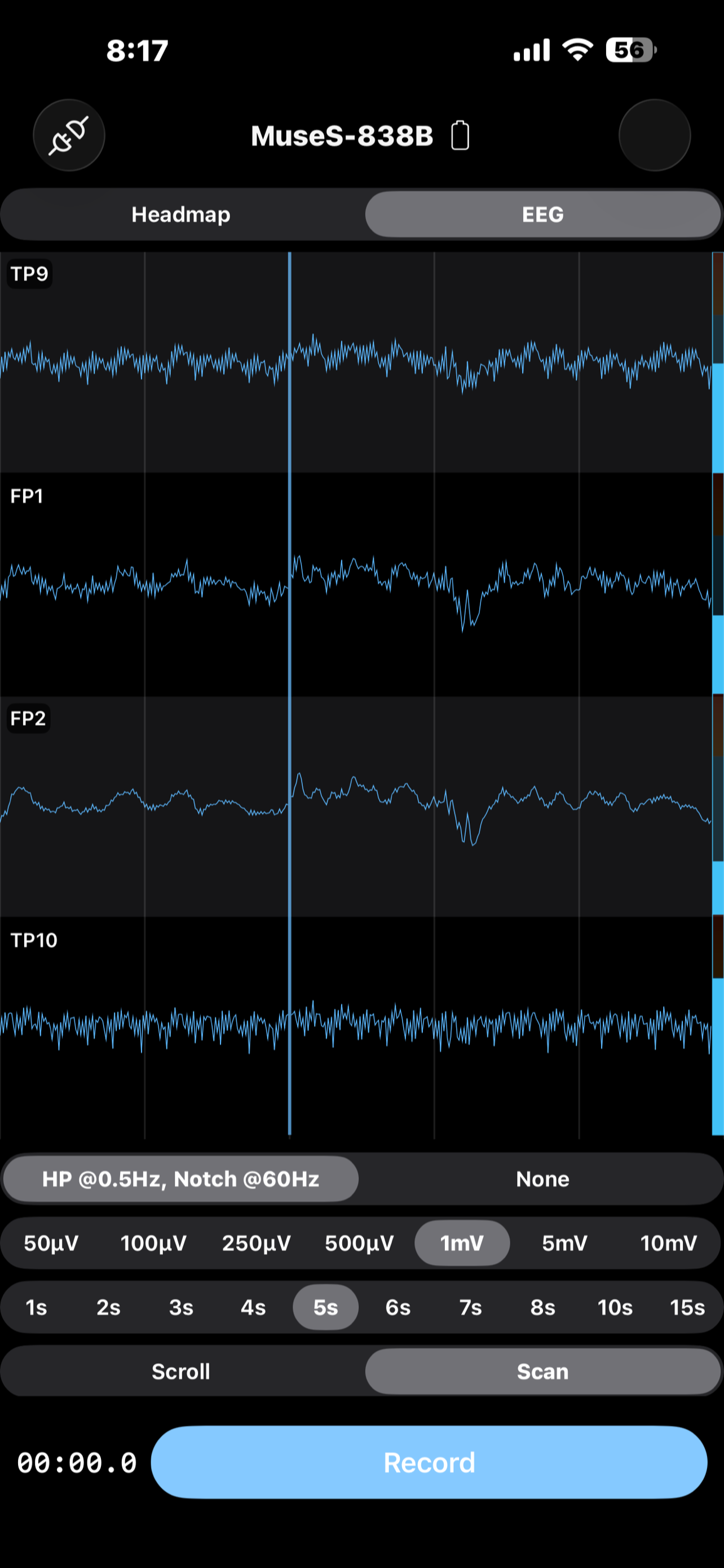 EEG Recorder