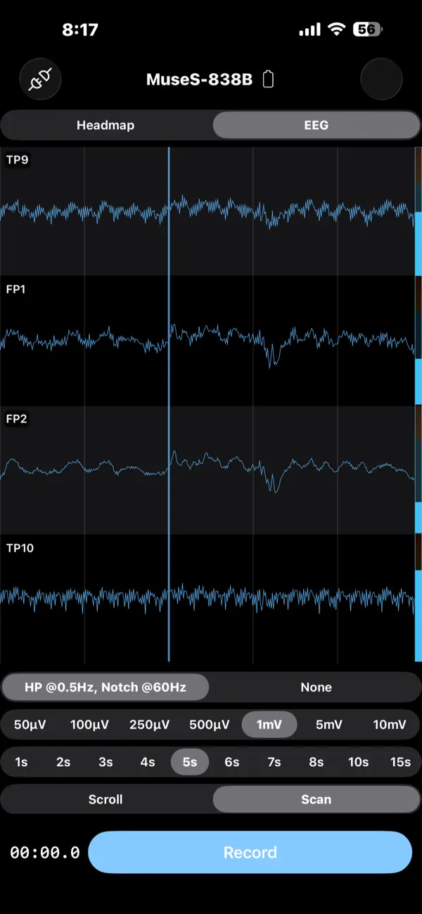 Screenshot #3 pour EEG Recorder