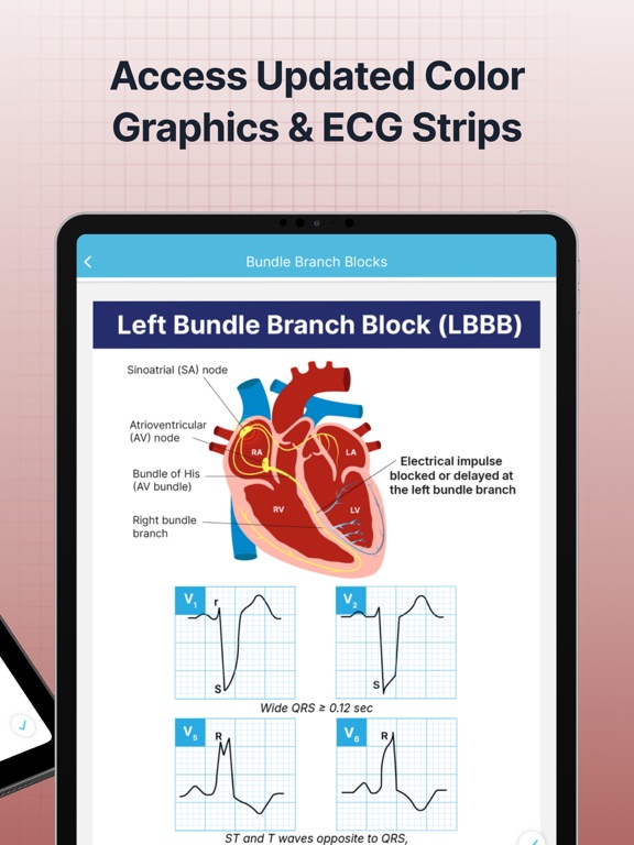 Screenshot #5 pour ECG EKG Interpretation Mastery