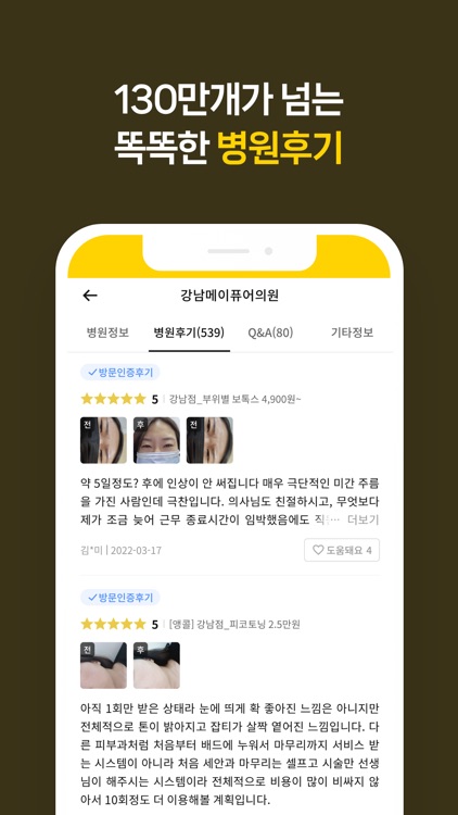 캐시닥 - 병원 찾기,시술 최저가 혜택,병원 예약 하기