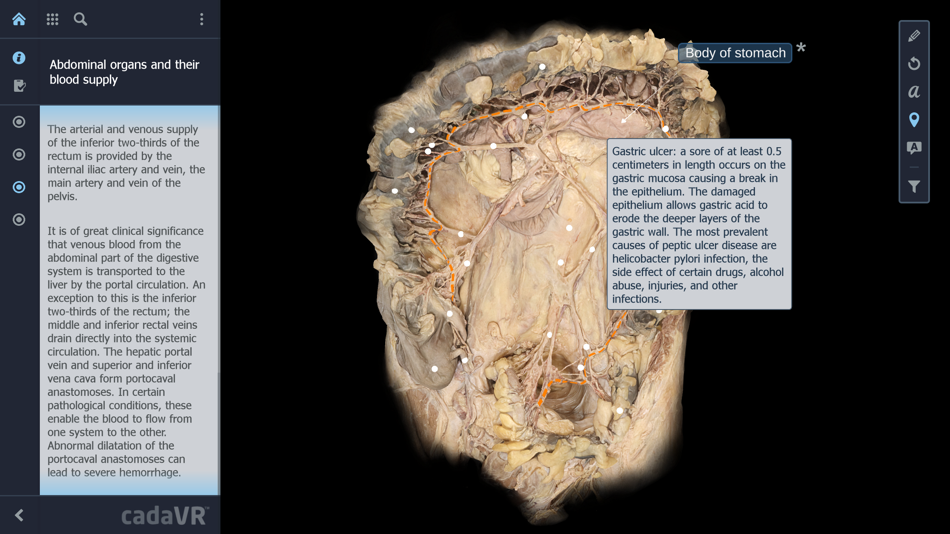 #4. cadaVR anatomy (iOS) By: MOZAIK Education Ltd.