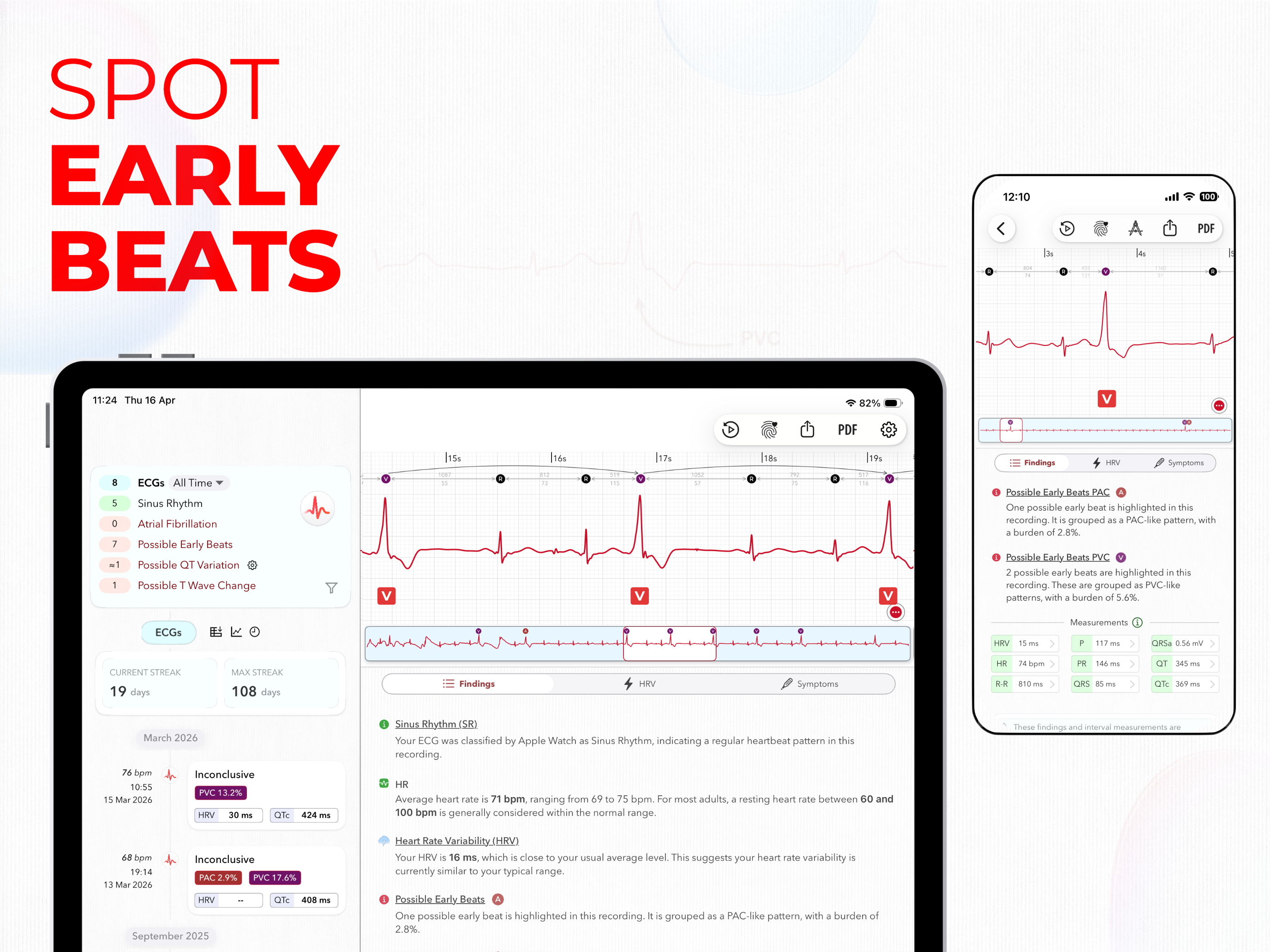 https://is1-ssl.mzstatic.com/image/thumb/PurpleSource221/v4/7f/df/2e/7fdf2ebb-ecab-9ec4-e8ea-3f16041bf19b/ecg_U002b_screenshots-47-homepage_-_ipad.png/2752x2064.png