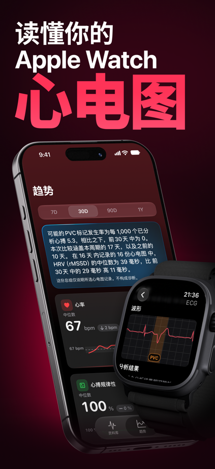 ECG Tracker+ EKG Reader HRV App Store screenshot 1
