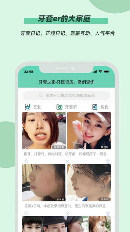 牙套之家-牙医资质查询、牙齿矫正真人案例 screenshot-3
