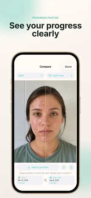 Accutane Tracker & Log: IsoPal screenshot 2
