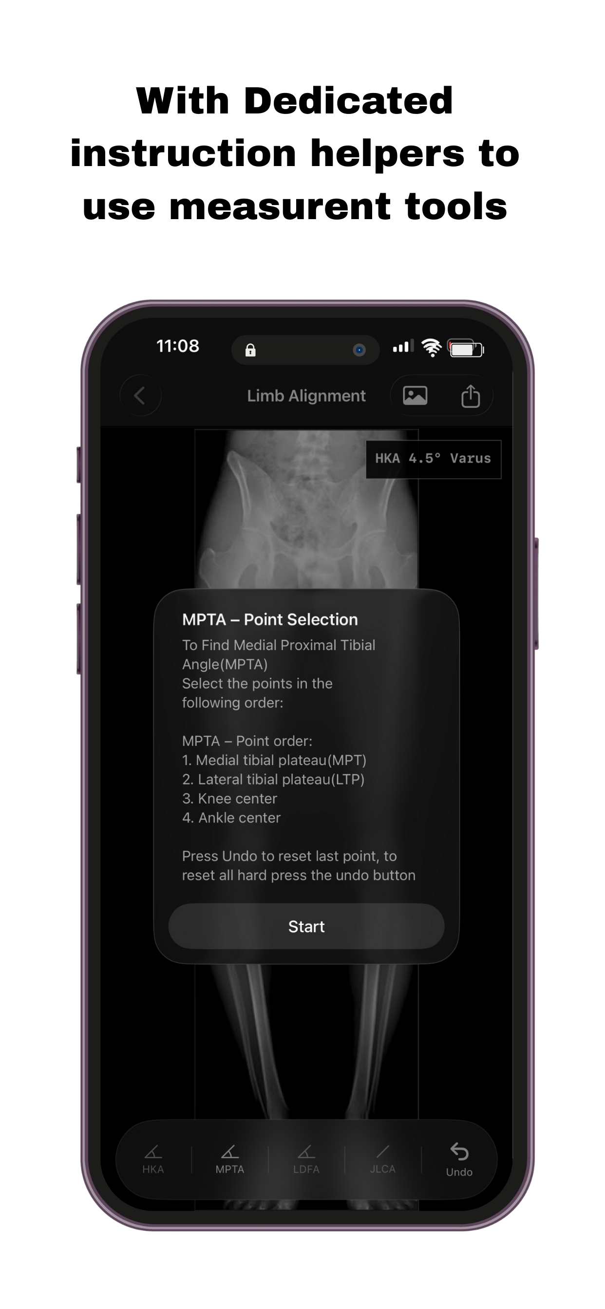 OsteoPlan screenshot 6