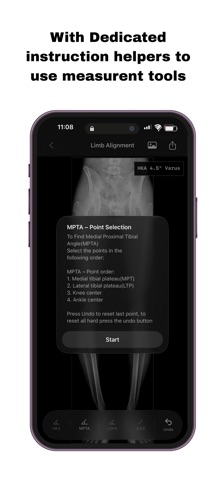 OsteoPlan screenshot