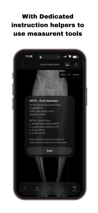 OsteoPlan Screenshot 6 of 10