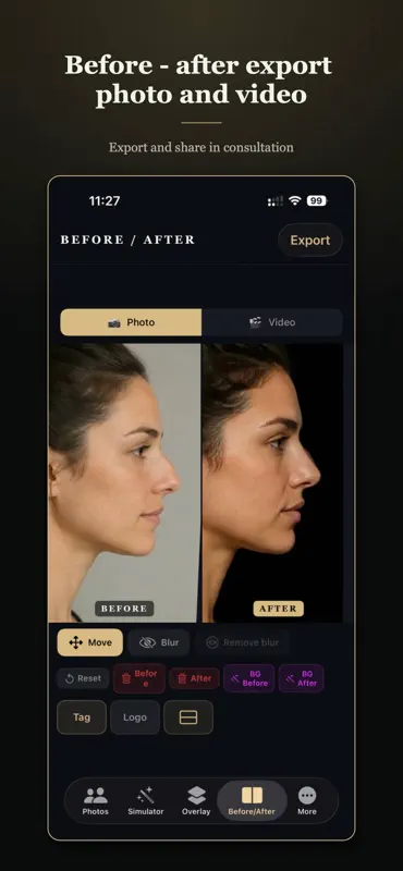 Rhinoplasty Simulator Pro screenshot 4 of 6