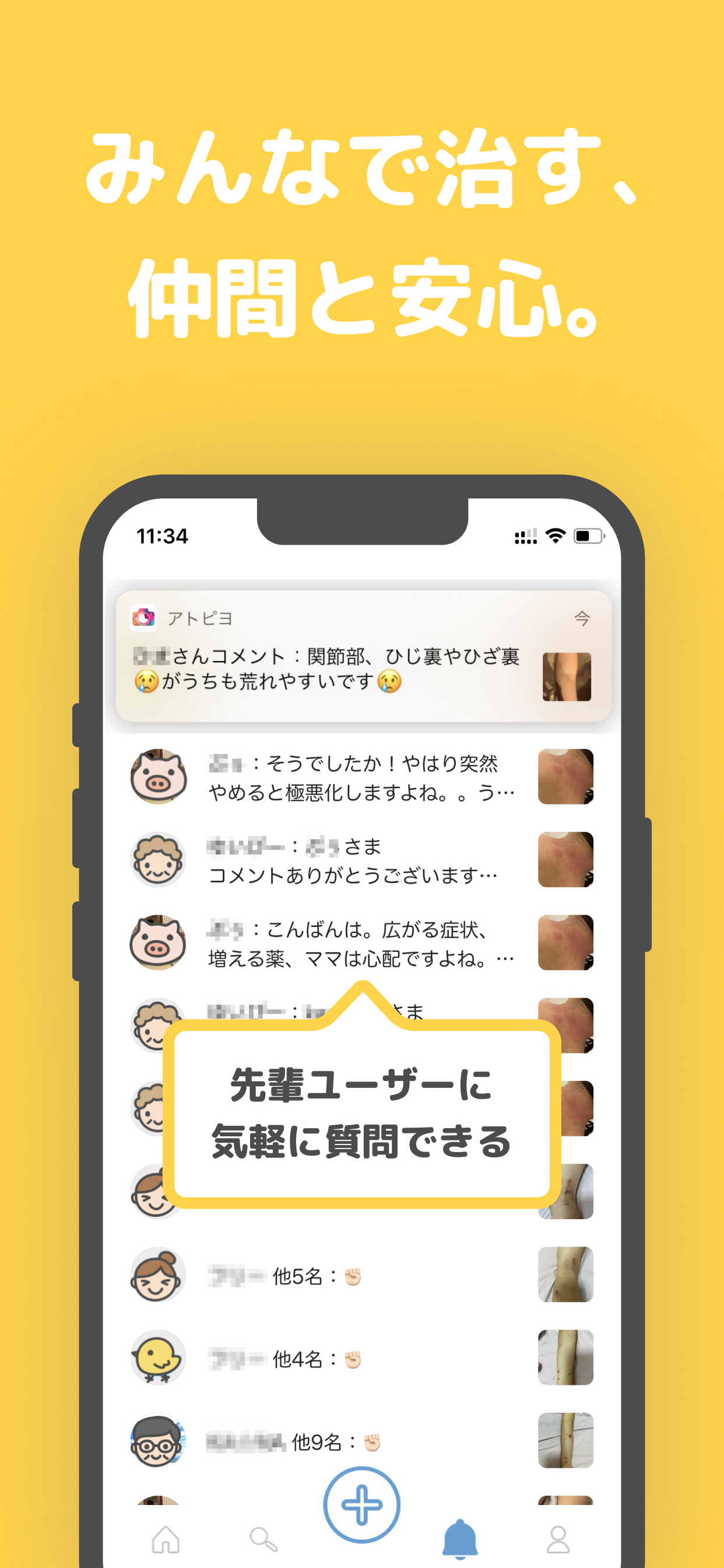 アトピー見える化アプリ-アトピヨ