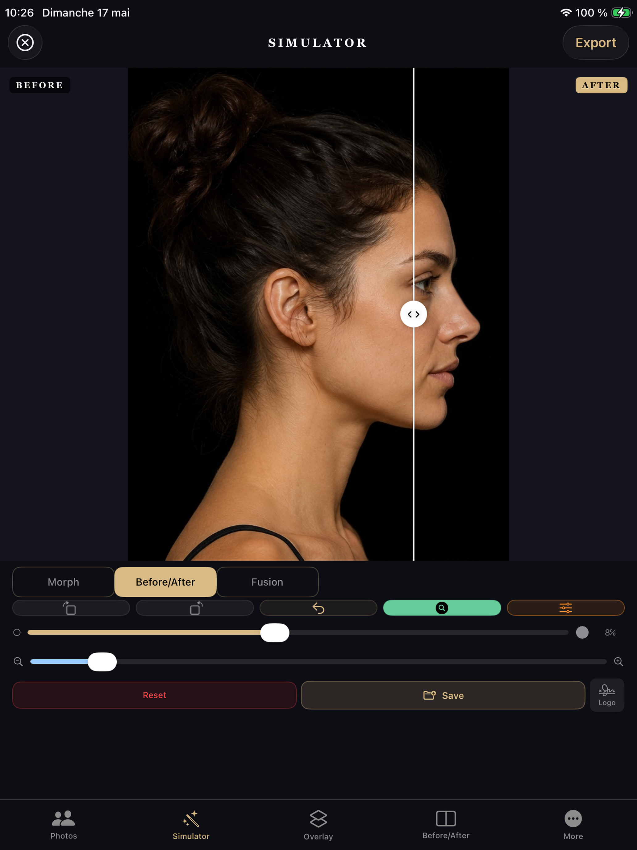 RhinoplastySimulator