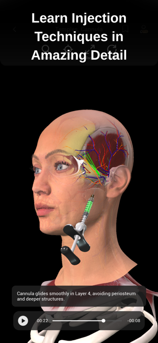 Injectomy: Anatomy+Animations Screenshot 2 of 8