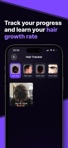 Hair Snap Health & Style Scan screenshot