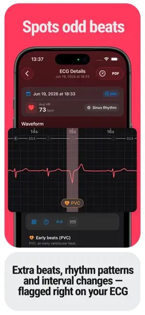 ECG Tracker+ EKG Reader HRV screenshot 2