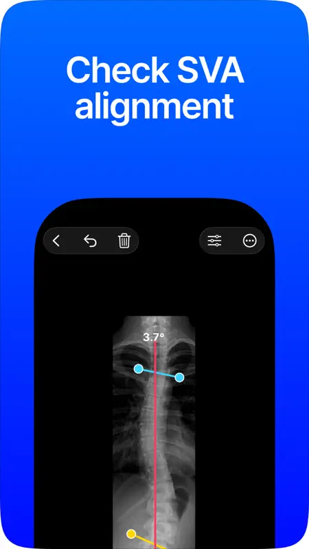 Cobb Angle Pro Radiografía screenshot 4 of 6