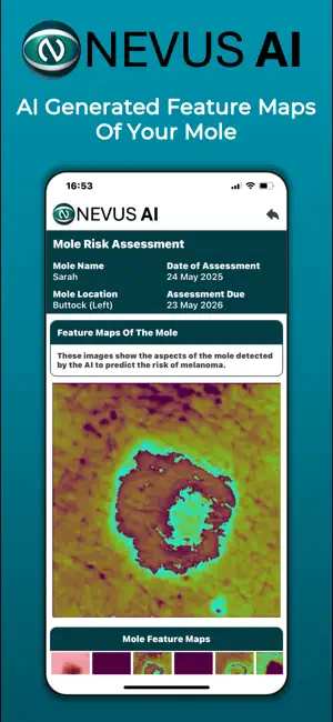 Nevus AI screenshot 2