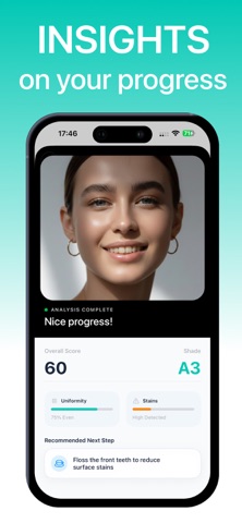 Whitely: Smile Bright Teeth screenshot