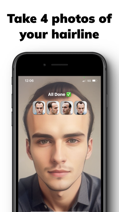 Hairline AI - Receding? Screenshot