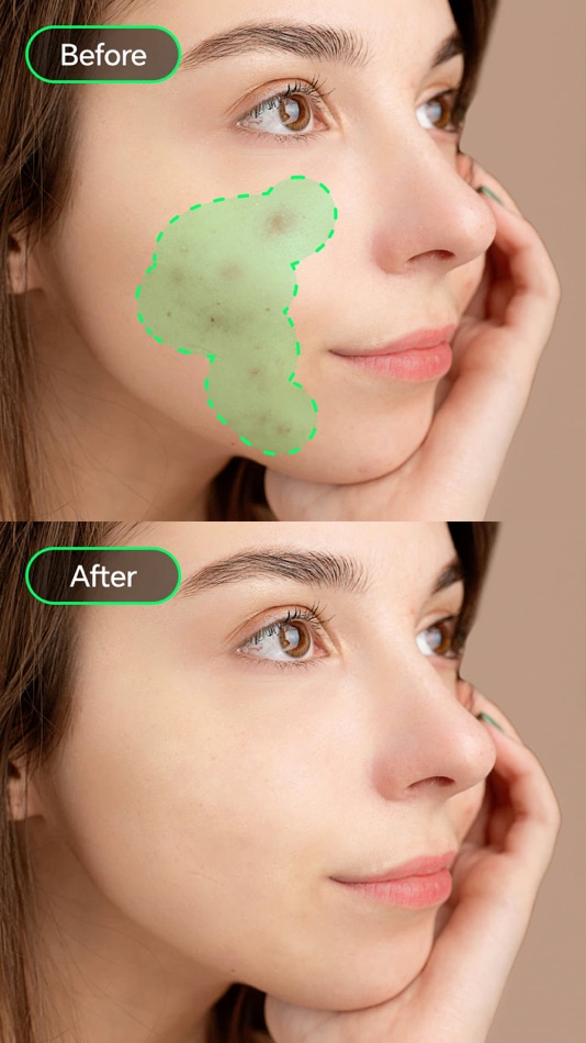 #2. Retouch AI:Pimple Remover (iOS) Przez: 广州盈锋智能软件技术有限公司