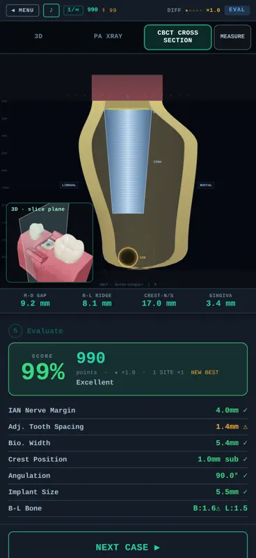 OsseoSim: Implant Trainer screenshot 5 of 5