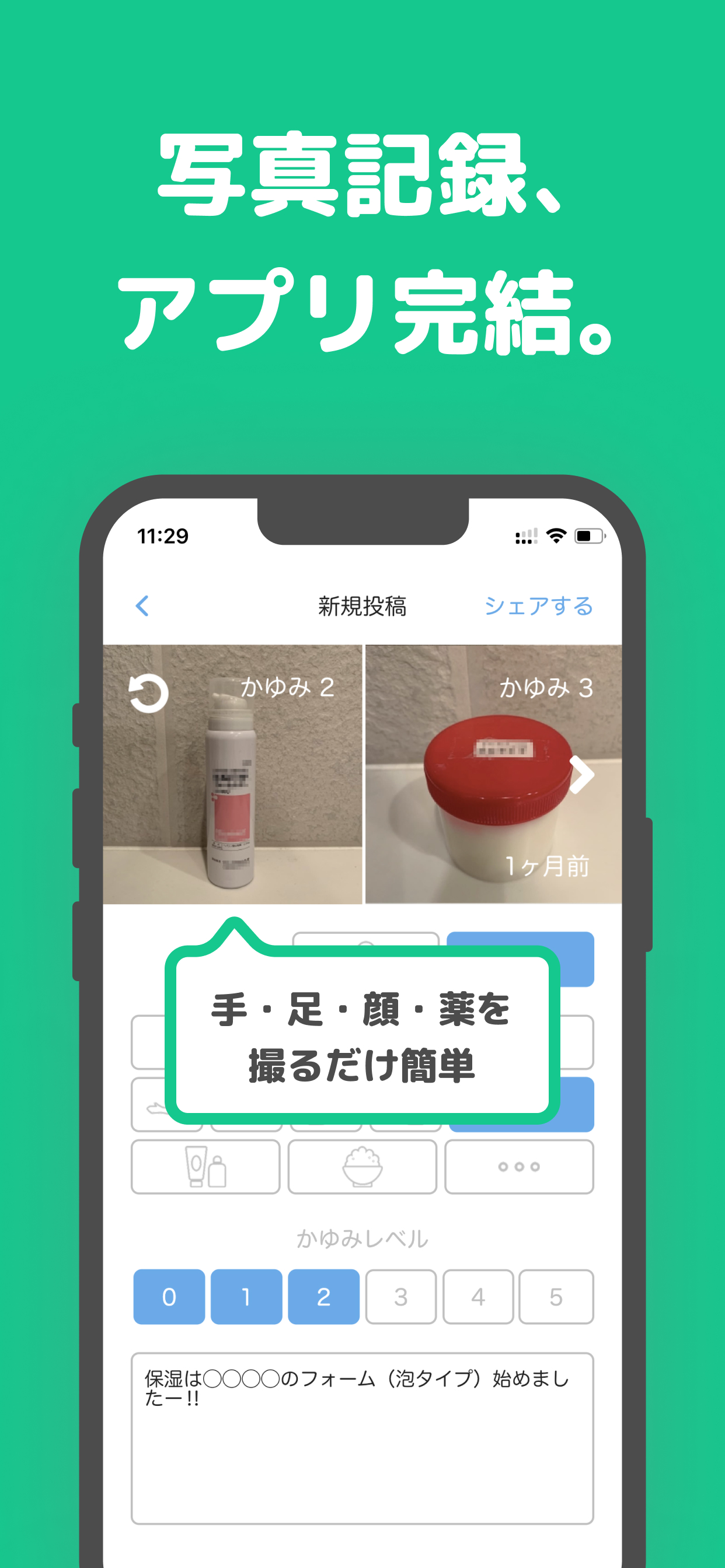 アトピー見える化アプリ-アトピヨ