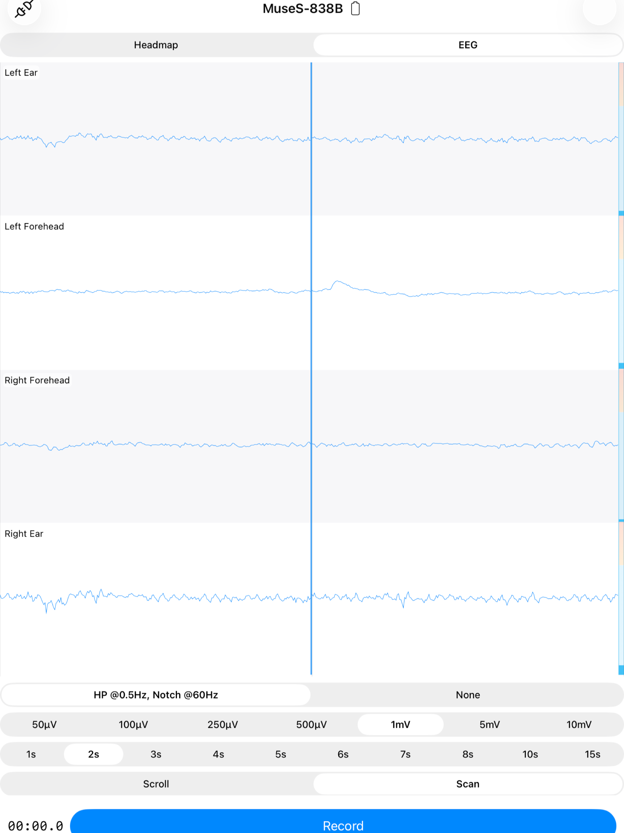 EEG Recorder