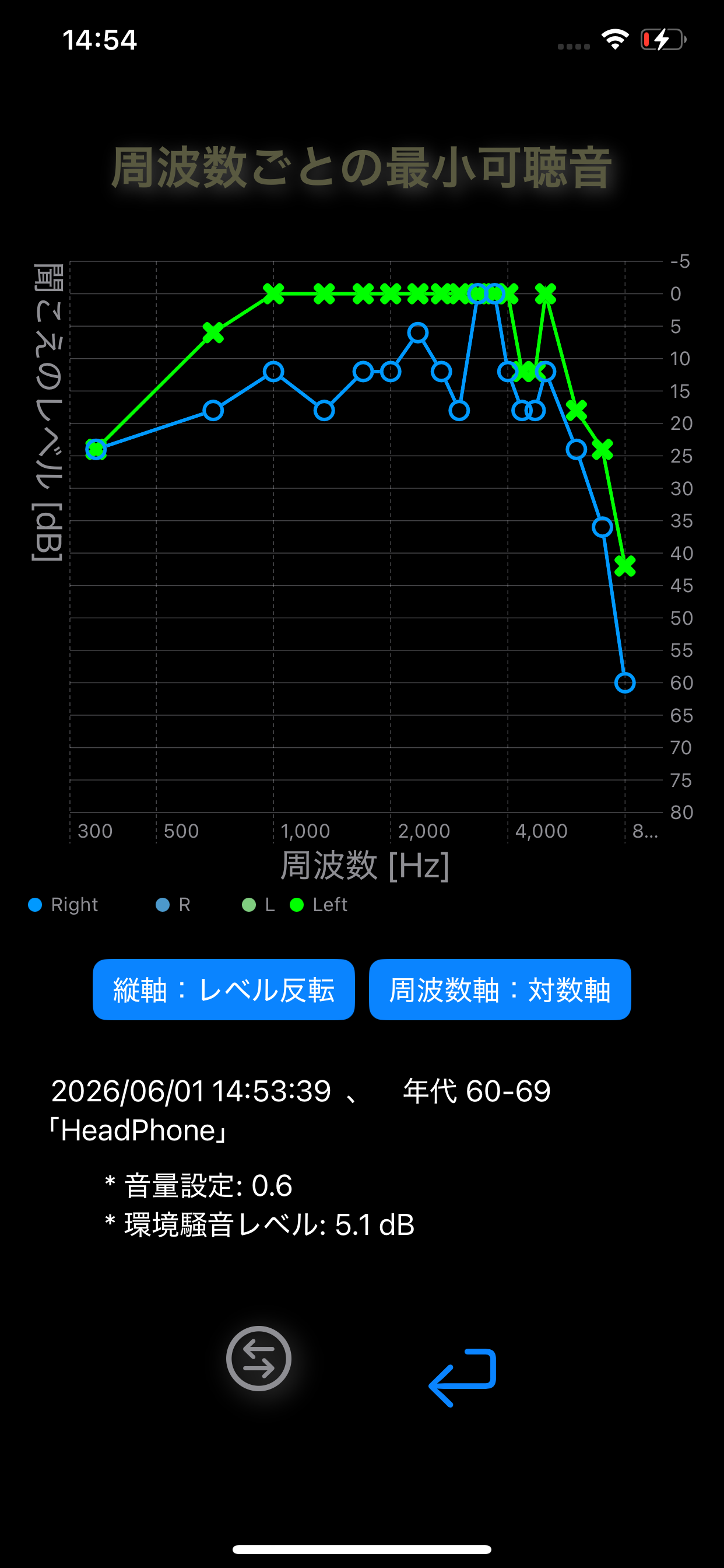 耳チェック
