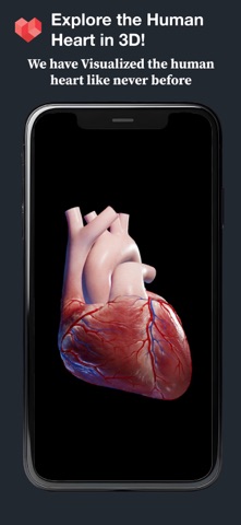 HeartVision Screenshot 1 of 3