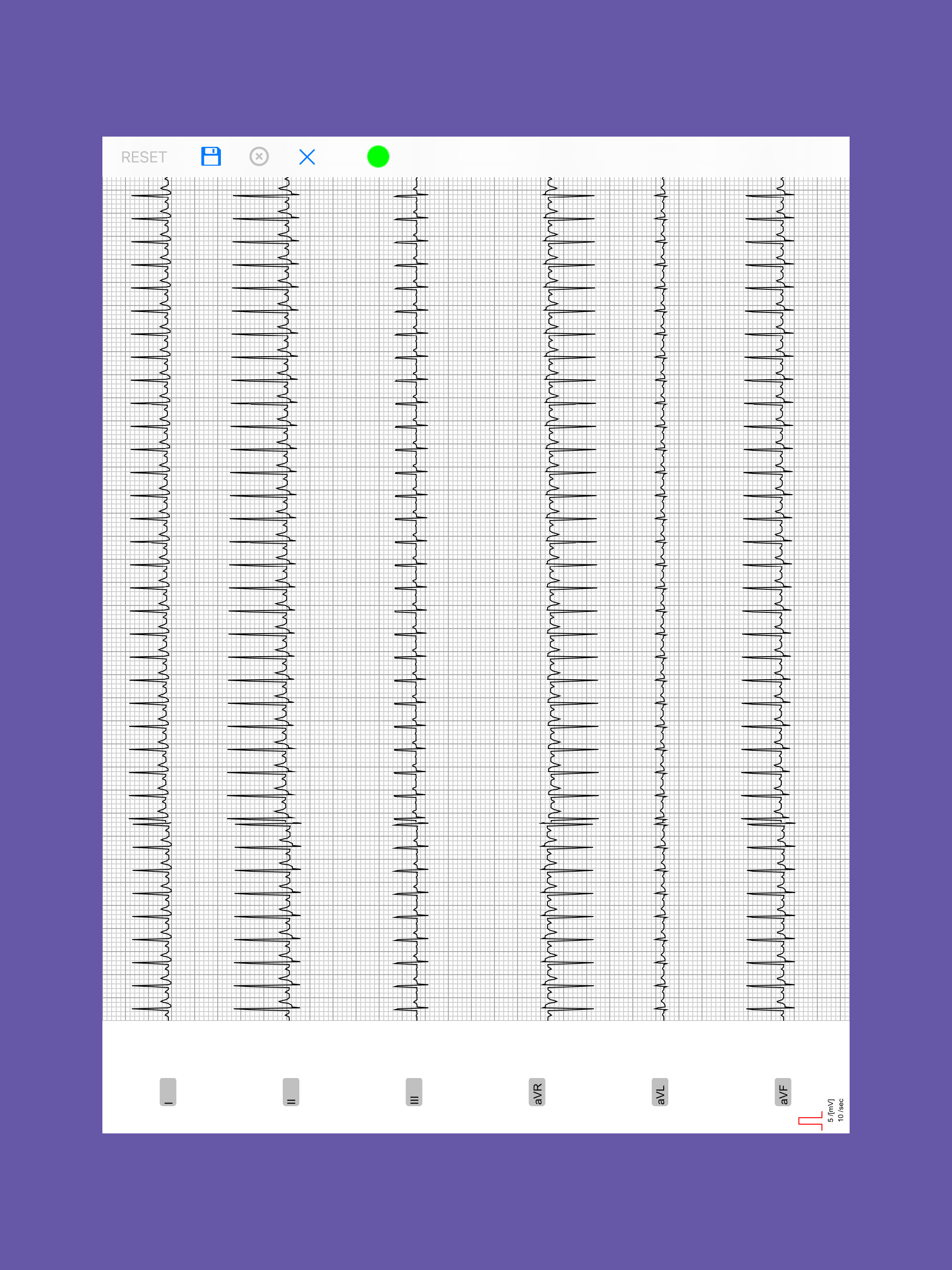 AIS ECG App screenshot 6