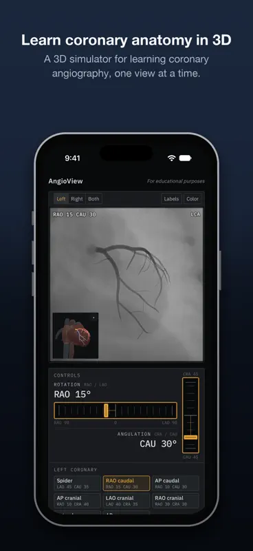 AngioView screenshot 1 of 5