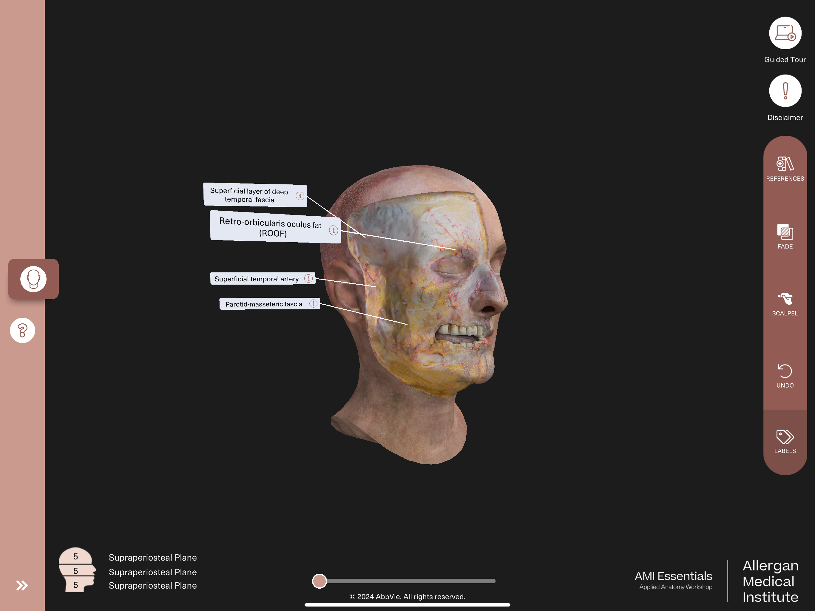 AMI Essentials:3D Anatomy BNL screenshot 19