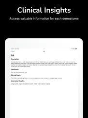 dermatome map and tuning fork ipad resimleri 3