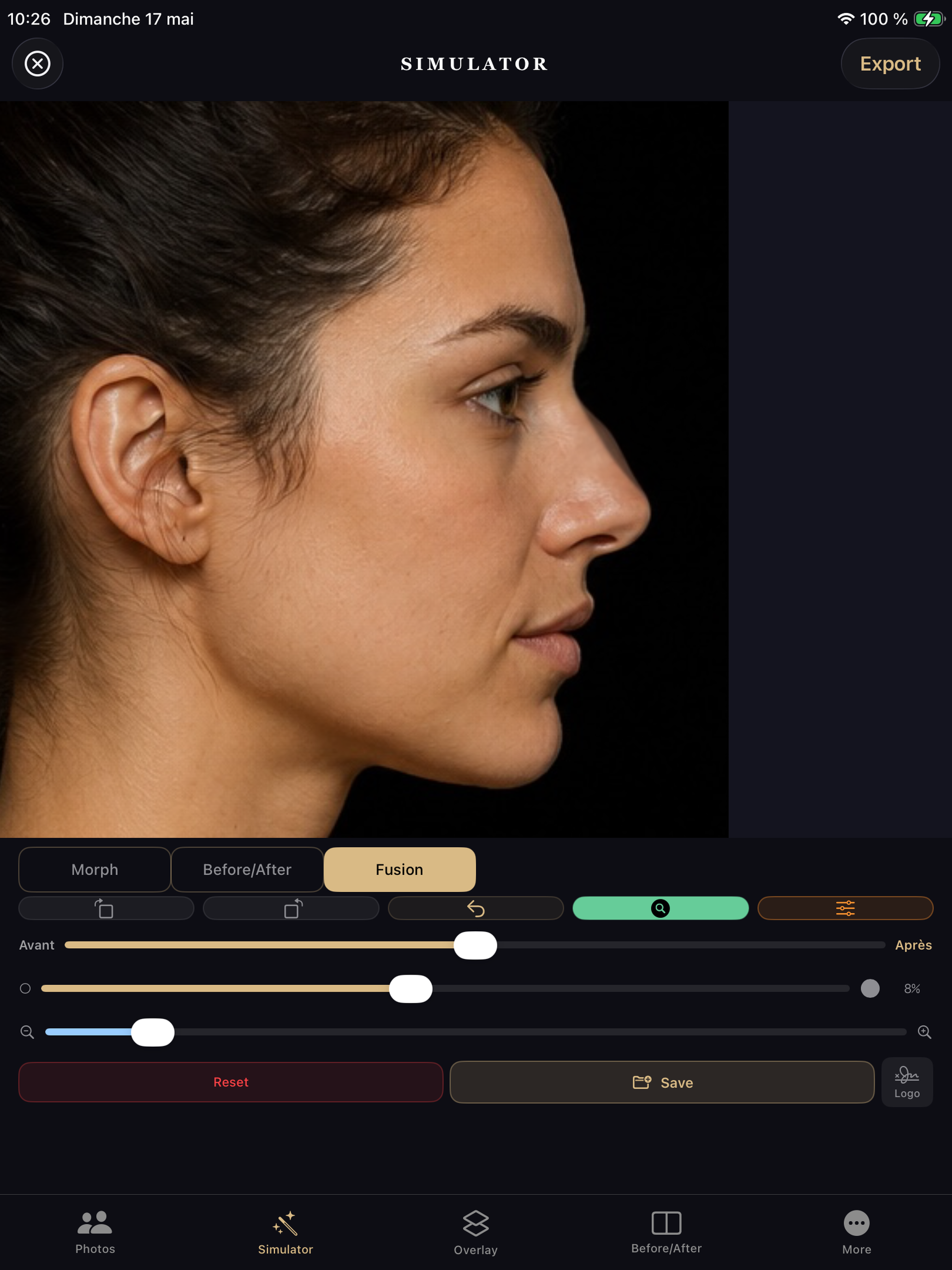 Rhinoplasty Simulator Pro