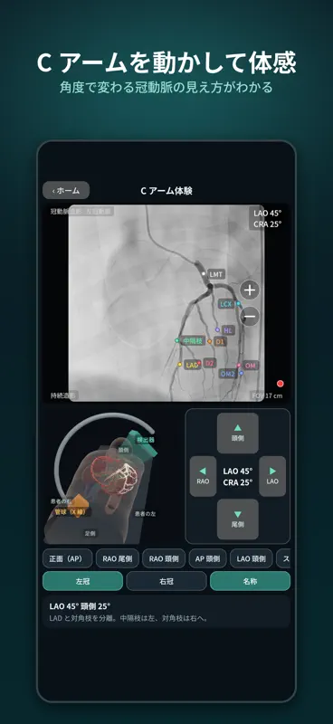 血液ガスCAG道場 screenshot 7 of 9