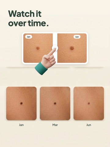 Mole Checker: Skin Scanner iPad screenshot