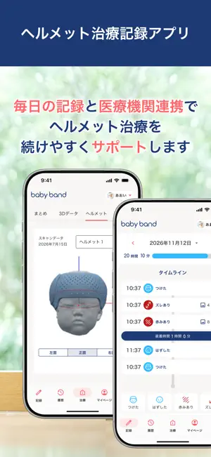 ヘルメット治療記録アプリ-babyband screenshot 1