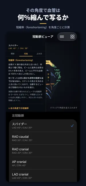 CAGView 冠動脈ビューア screenshot 1