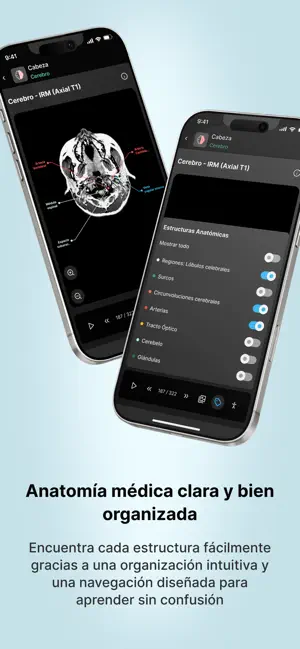 Atlas of Radiological Anatomy screenshot 1
