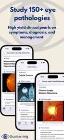 OcuLearning - Ophthalmology screenshot