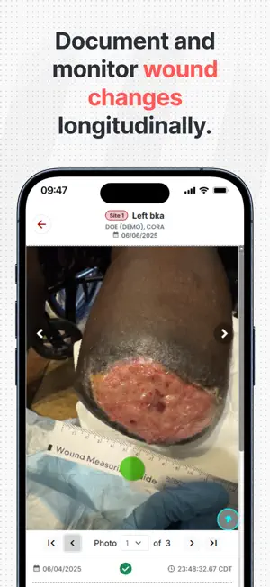 WoundSnap.ai screenshot 4