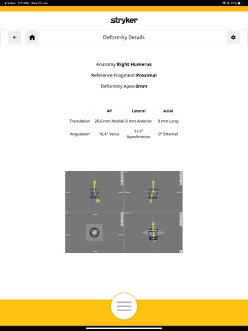 Stryker HexConnect iPad screenshot