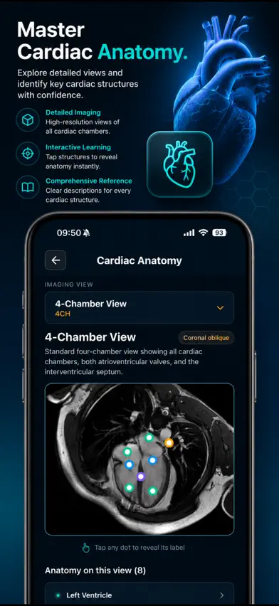 MyoScan IQ: Cardiac MRI Guide screenshot 4