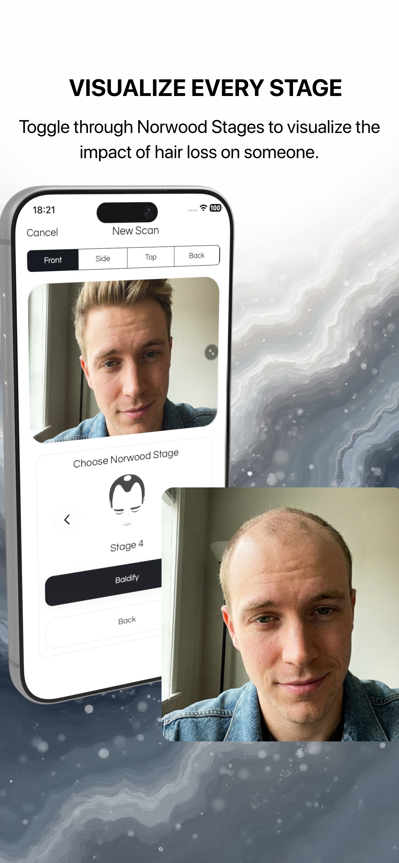 Hair Loss Tracker - BaldingAI